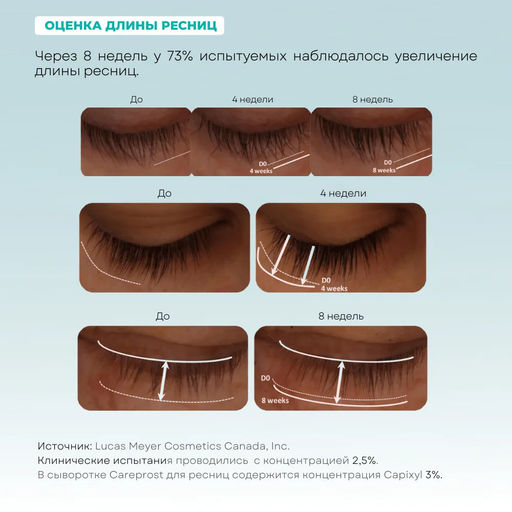 Сыворотка для роста ресниц Careprost CLASSIC, 3 мл  фото 5