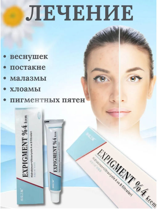 Крем от пигментных пятен и веснушек на лице Expigment - Buro фото 2