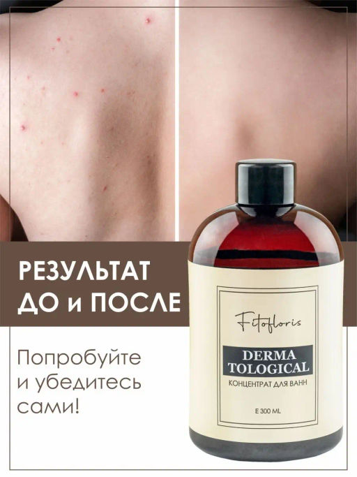 Концентрат для ванн Фитофлорис дерматологический Алфит Плюс 1753 фото 7