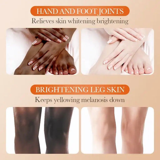 SADOER Отбеливающий крем Dark Knuckle для интимных зон, бикини, локтей, колен, для тела, 140гр.  фото 2