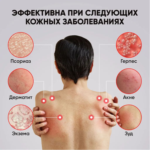 Мазь-крем от высыпаний на спине, псориаза, экземы, атопического дерматита,акне 20гр - Aopen фото 4