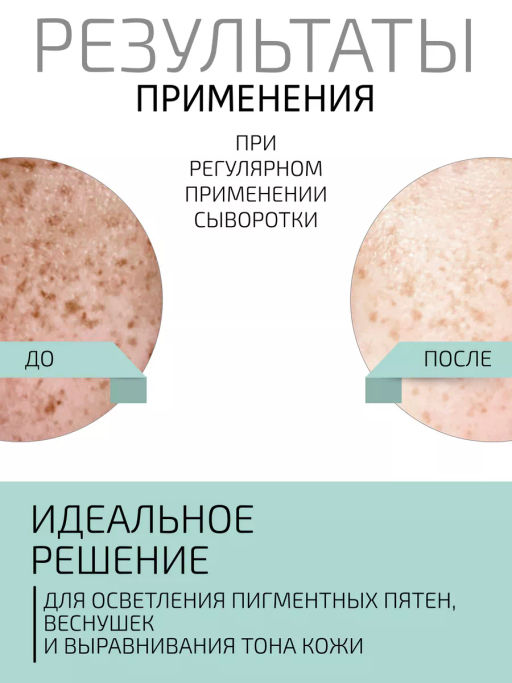 Сыворотка BTpeel липосомальная с койевой и гиалуроновой кислотой 30 мл  фото 7
