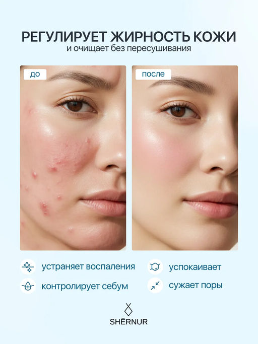 Тоник себорегулирующий для жирной и проблемной кожи лица, 150 мл - SHERNUR фото 3