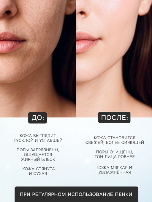 Новогодняя пенка для умывания Sadoer, авокадо, 120 мл