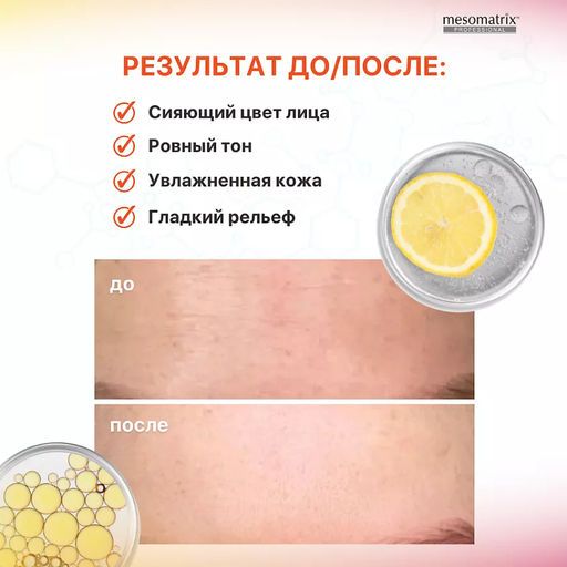 VITA-C ANTIOX, Крем для лица антиоксидантный с витамином С и феруловой кислотой