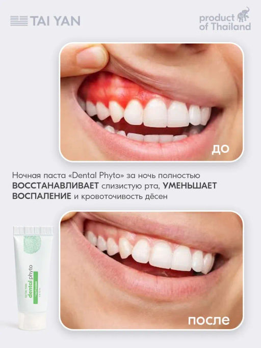 Тревел набор зубных паст 2*10 гр, 111-06 - Bonimed фото 7