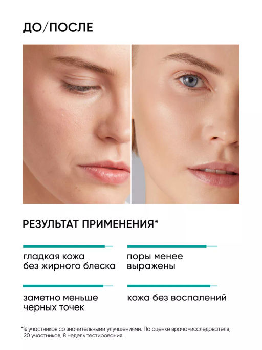 15% AHA+BHA пилинг для лица - Icon skin фото 3