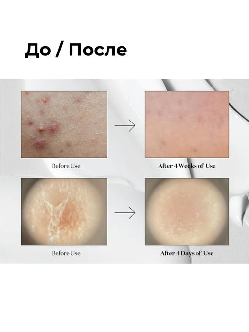VT Cosmetics Бустер-сыворотка для лица с микроиглами и экстрактом центеллы азиатской / Reedle Shot 100, 50 мл