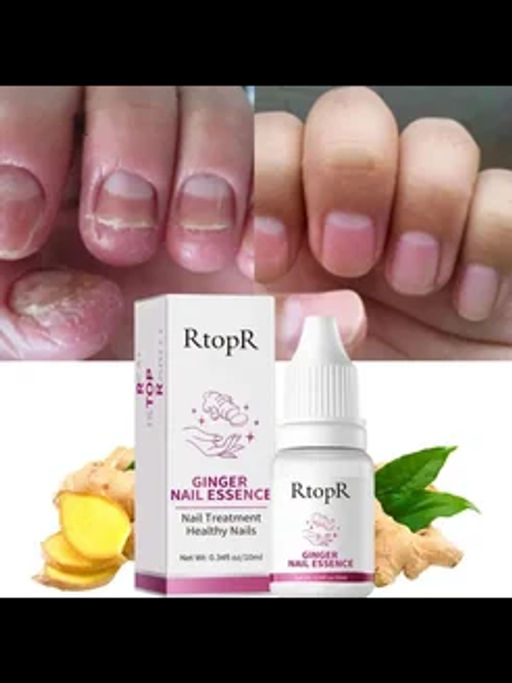 Похожие   RtopR средство для удаления кутикулы, уход за ногтями: 10мл - Cahnsai фото 2