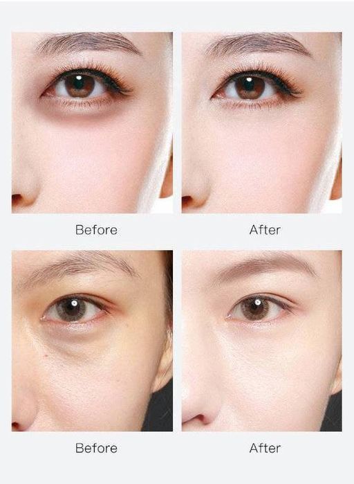 Гидрогелевые патчи c экстрактом цитруса Юдзу от темных кругов и отечности под глазами, 60шт - Images фото 4