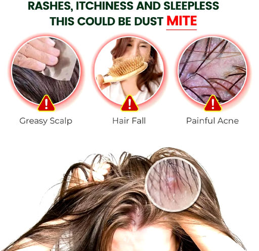 Мазь Aopen от подкожных клещей и вшей для людей и животных 20 мл  фото 3