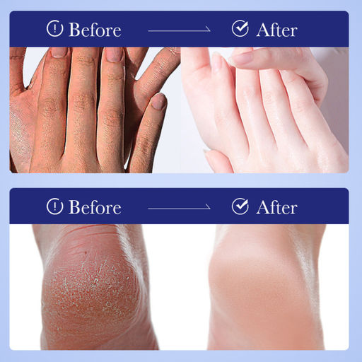 SADOER Увлажняющиц крем от сухости и трещин с маслом авокадо Anti-Crack Avocado Repair Cream, 75гр.  фото 4