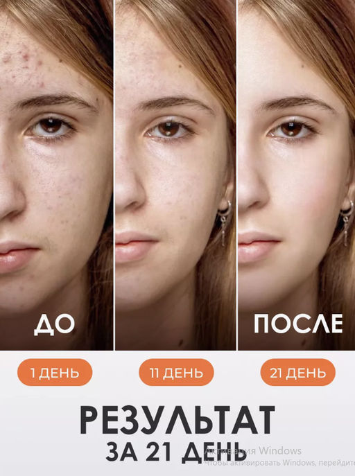 Миниатюра ISNTREE Chesnut AHA 8% Clear Essence (20 мл)  фото 3