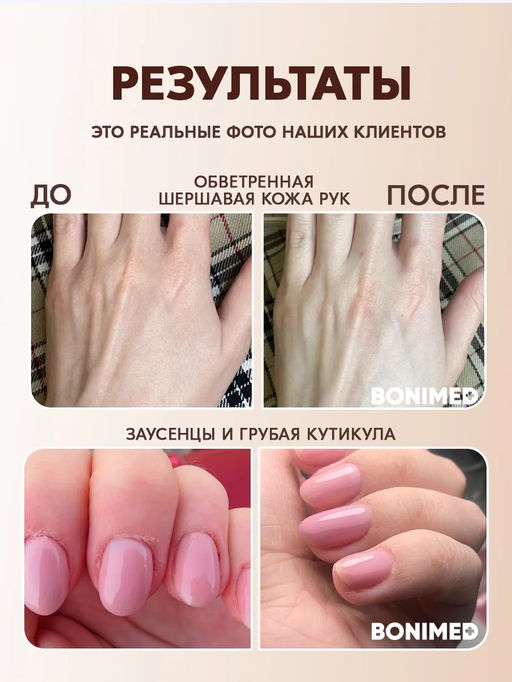 Крем от трещин, сухости и шелушений BONIMED REHABER, 100 гр  фото 10