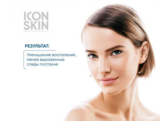 Сыворотка-пилинг для лица ночная с комплексом AHA + PHA + BHA кислотами. Комбинированная, жирная и п