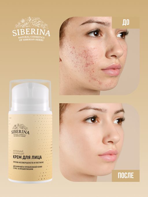 Матирующий крем для лица против несовершенств и постакне для жирной и проблемной кожи с про- и пребиотиками - Siberina фото 7