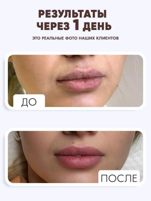 Бальзам для губ от трещин Bonimed, 2,6 г, Boni-0107