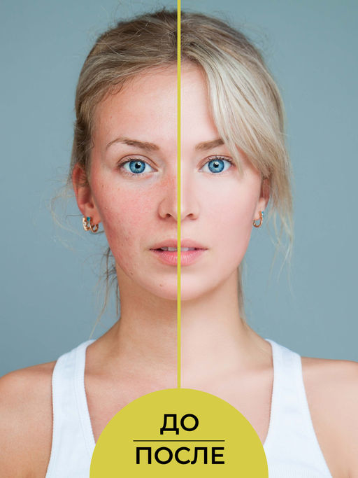 Успокаивающий крем для лица после пилинга - Siberina фото 8