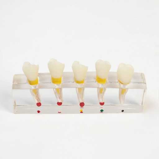 Анатомическая модель «Макет зуба с патологиями», 10×4×2 см