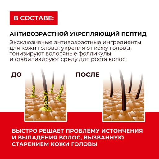 KANS Шампунь для жирных волос и кожи головы calp Oil-controlling Shampoo, 300 г  фото 4