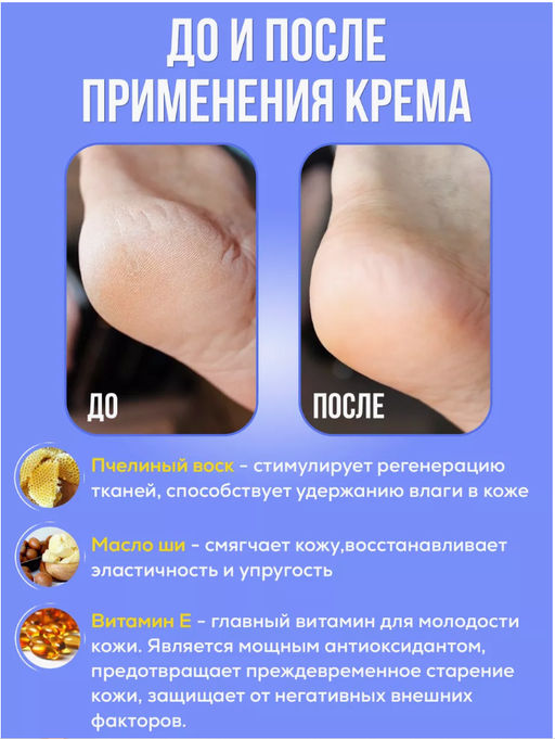 Крем от трещин и шелушений для сухой кожи - Sadoer фото 5