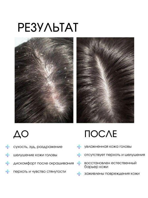 System 4 Терапевтический лосьон М, 150 мл - Sim sensitive фото 3