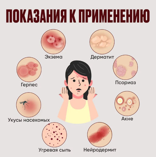 Китайская чудо мазь от атопического дерматита, экземы,акне / Китайская чудо мазь 15гр - Aopen фото 4