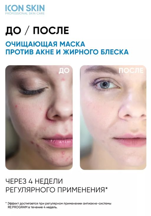 ICON SKIN Косметическая маска для лица от прыщей, акне и жирного блеска. Для проблемной кожи.50 мл  фото 4