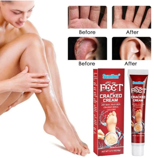 Крем для поврежденной кожи рук и ног 20g - Aopen фото 3