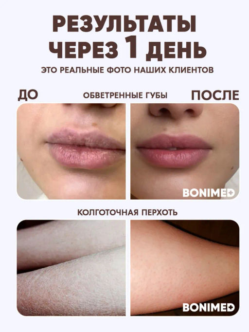 Крем профессиональный от сухости и трещин Bonimed 500 мл Boni-0108  фото 6