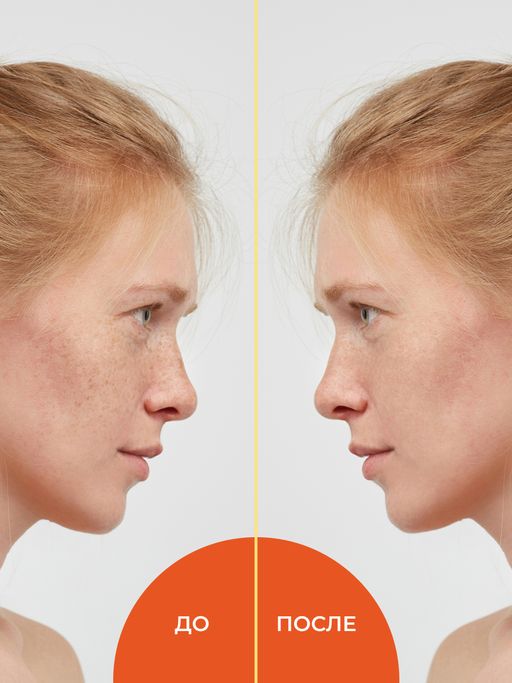 Комплекс гидролатов Осветляющий против пигментных пятен и веснушек 50 мл - Siberina фото 7