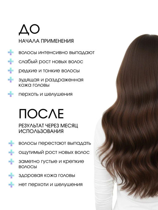 System 4 Комплекс от выпадения волос стандарт - Sim sensitive фото 4