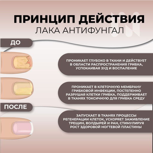 Сыворотка Антифунгал Органик с Тимолом, 6,5 мл - Masura фото 4