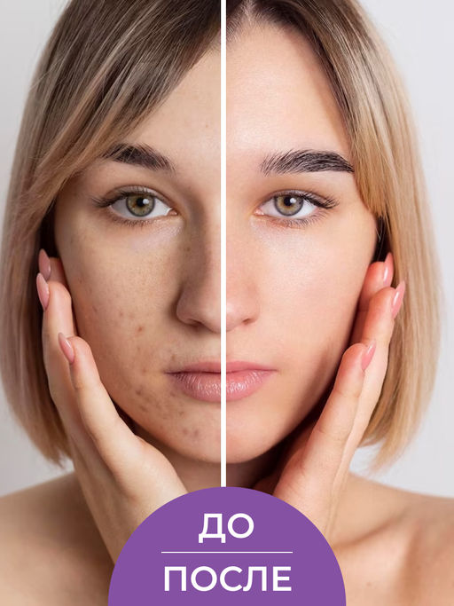 Тоник для лица противовоспалительный 200 мл SIBERINA