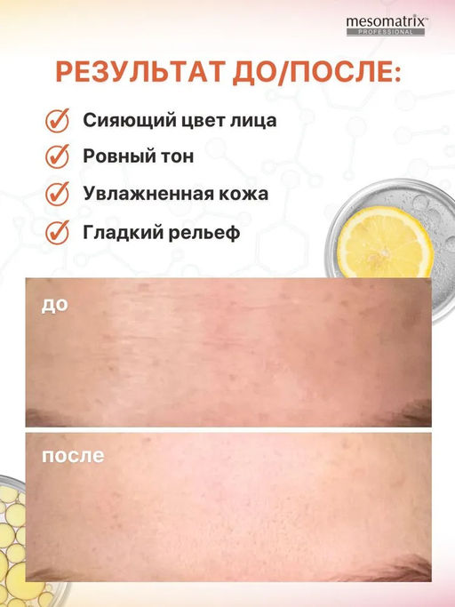 VITA-C CENTELLA, тоник