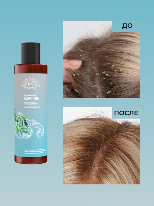 Шампунь "Против перхоти и выпадения волос" с цинком и маслом ним SIBERINA