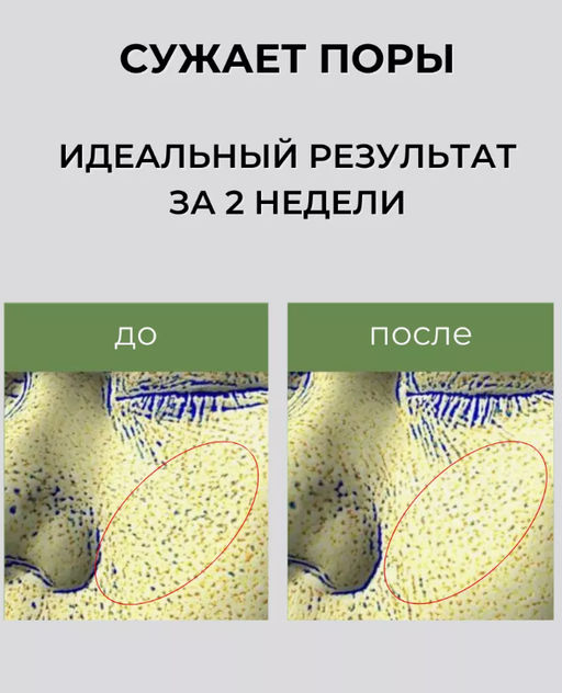 KAINE Сыворотка ночная противовоспалительная с розмарином и кислотами Rosemary AHA Night Serum (30 мл)  фото 5