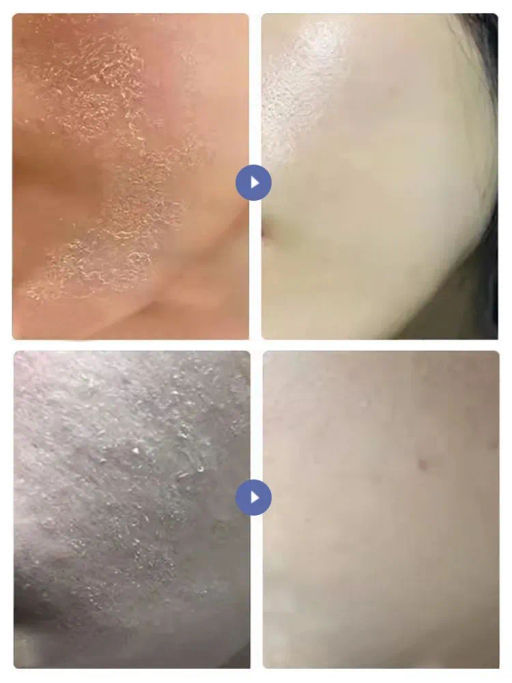 Крем для тела с мочевиной и витамином Е, 100 мл - Baizton фото 2