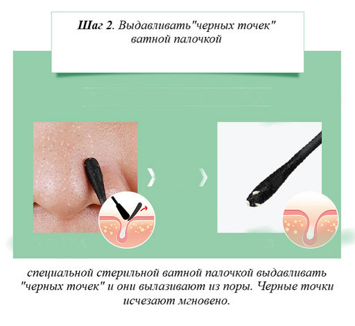 Комплексное очищение  чёрных точек - Jlisa фото 3