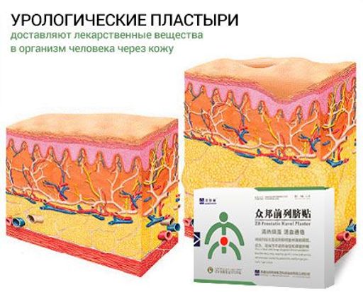 Пластырь от простатита Prostatic Navel Plasters до 2018 . 03 - Elaimei фото 5