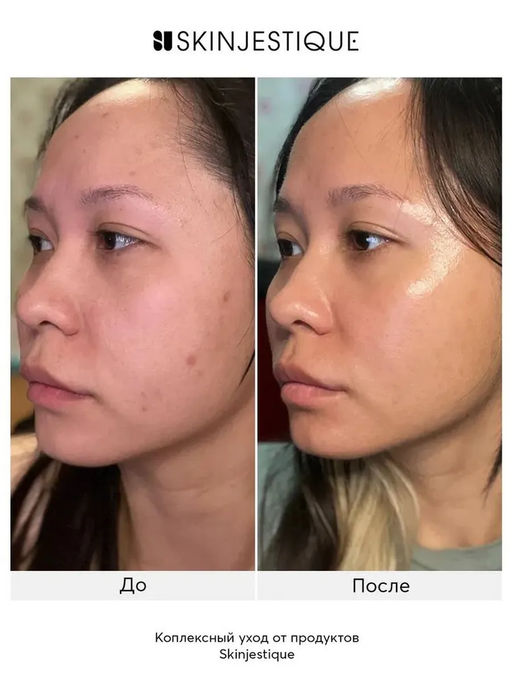 Пептидный гель для умывания с олигопептидом VEZE, 60 г FZ56394  фото 6