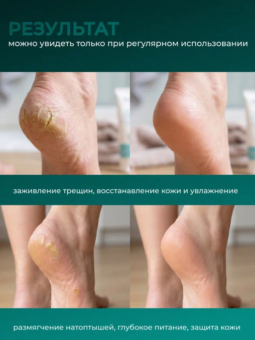 Manita Professional Крем для ног с мочевиной и ментолом, 460 мл  фото 5