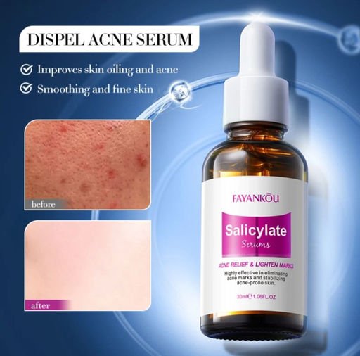 FAYANKOU Сыворотка для проблемной кожи лица 30мл - Sadoer фото 5