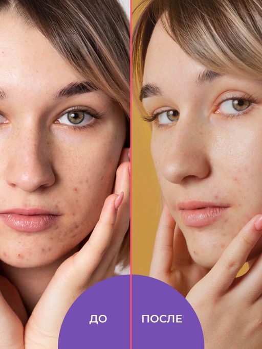 Тоник для лица противовоспалительный 50 мл - Siberina фото 10