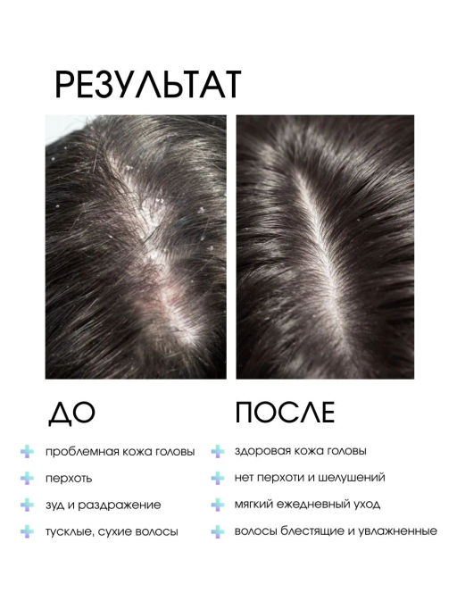 System 4 Терапевтический шампунь №3, 500 мл - Sim sensitive фото 3