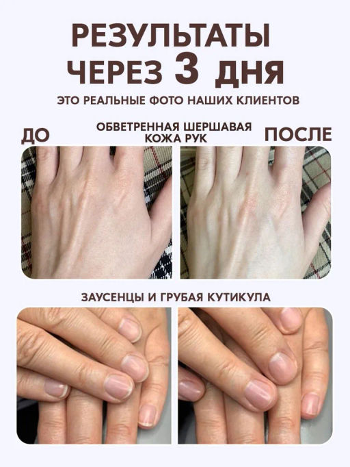 Крем для тела от сухости и трещин Bonimed, 125 мл Boni-0101