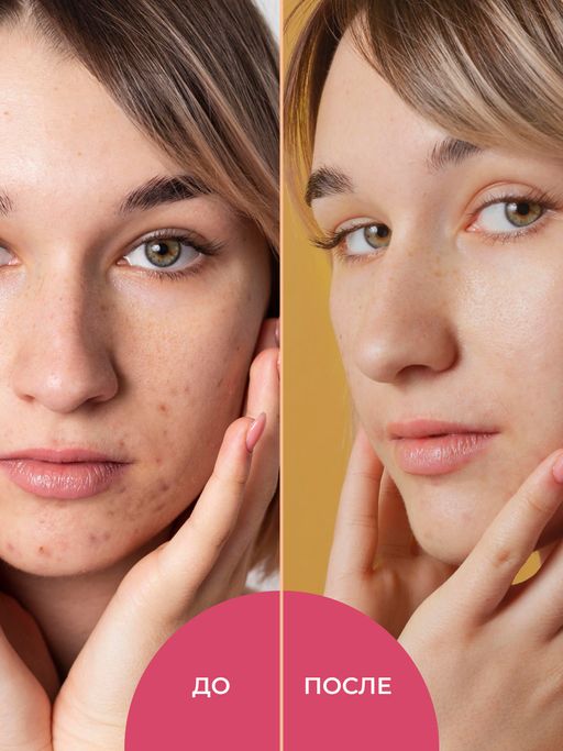 Скраб для лица Мягкий пилинг - Siberina фото 8