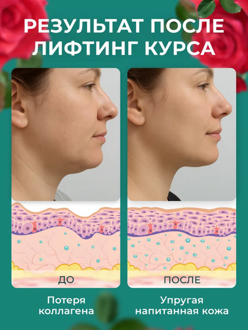 Подтягивающая тейп лифтинг маска для подбородка и овала лица (3610)