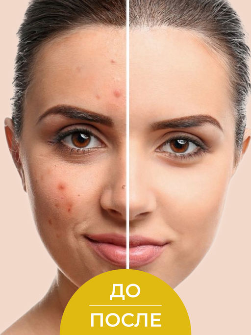 Пилинг для лица с фруктовыми кислотами SIBERINA