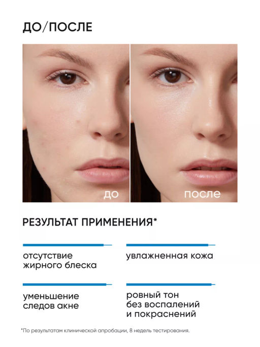 Увлажняющий крем для лица склонной к акне - Icon skin фото 3
